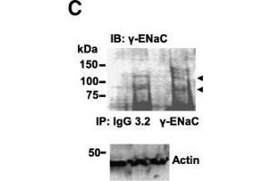 Western Blotting (WB) image for anti-Sodium Channel, Nonvoltage-Gated 1 alpha (SCNN1A) (AA 629-650) antibody (ABIN863204)