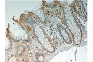 Image no. 1 for anti-Interleukin 12 beta (IL12B) (Internal Region) antibody (ABIN374765) (IL12B 抗体  (Internal Region))