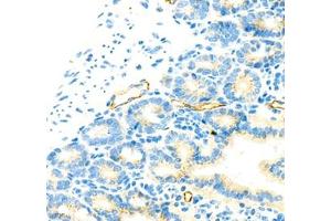 Immunohistochemistry (Paraffin-embedded Sections) (IHC (p)) image for anti-Mucosal Vascular Addressin Cell Adhesion Molecule 1 (MADCAM1) antibody (ABIN7074695)