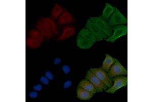 ABIN6257896 and ABIN6274807 staining Hela cells by IF/ICC. (ACOT8 抗体  (Internal Region))