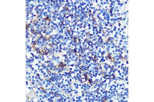 Immunohistochemistry of paraffin-embedded human spleen using HLA-DRA Rabbit mAb (ABIN7267758) at dilution of 1:100 (40x lens). (HLA-DRA 抗体)