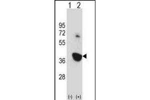 Western blot analysis of Nek6 (arrow) using rabbit polyclonal Mouse Nek6 Antibody (C-term) (ABIN657847 and ABIN2846808). (NEK6 抗体  (C-Term))