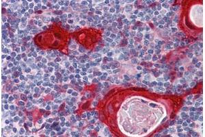 Human Thymus: Formalin-Fixed, Paraffin-Embedded (FFPE) (14-3-3 sigma/SFN 抗体  (AA 1-249))