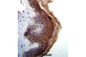 Immunohistochemistry (IHC) image for anti-Interleukin 1 delta (FIL1d) antibody (ABIN5016258) (FIL1d 抗体)