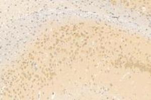 Immunohistochemistry analysis of paraffin-embedded mouse brain using,Neuroligin 3 (ABIN7074816) at dilution of 1: 1200 (Neuroligin 3 抗体)