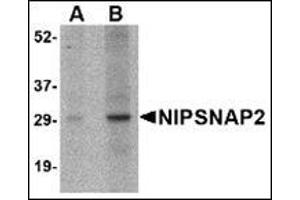 Western blot analysis of NIPSNAP2 in human skeletal muscle tissue lysate with this product at (A) 1 and (B) 2 μg/ml. (GBAS 抗体  (Center))