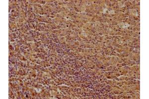 IHC image of ABIN7139916 diluted at 1:100 and staining in paraffin-embedded human tonsil tissue performed on a Leica BondTM system. (LPAR5 抗体  (AA 310-326))