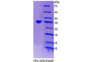 SDS-PAGE analysis of Human EPRS Protein. (EPRS 蛋白)