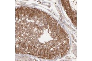 Immunohistochemical staining (Formalin-fixed paraffin-embedded sections) of human testis with MAPRE1 polyclonal antibody  shows strong cytoplasmic positivity in cells of seminiferous ducts. (MAPRE1 抗体)