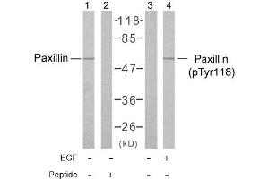 Image no. 1 for anti-Paxillin (PXN) (pTyr118) antibody (ABIN196777)
