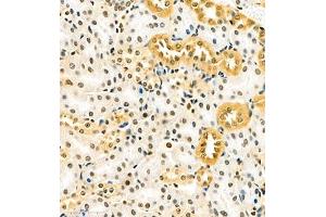 Immunohistochemistry of paraffin embedded mouse kidney using RB1 (ABIN7075477) at dilution of 1:700 (400x lens)