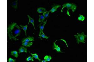 Immunofluorescent analysis of MCF-7 cells using ABIN7146610 at dilution of 1:100 and Alexa Fluor 488-congugated AffiniPure Goat Anti-Rabbit IgG(H+L) (PKIB 抗体  (AA 1-77))