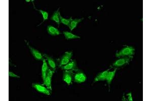 Immunofluorescent analysis of Hela cells using ABIN7147724 at dilution of 1:100 and Alexa Fluor 488-congugated AffiniPure Goat Anti-Rabbit IgG(H+L) (CHD5 抗体  (AA 1600-1699))