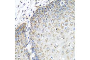 Immunohistochemistry of paraffin-embedded human esophagus using TMOD3 antibody (ABIN5972684) at dilution of 1/100 (40x lens). (TMOD3 抗体)