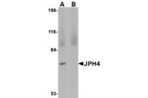 Image no. 1 for anti-Junctophilin 4 (JPH4) (C-Term) antibody (ABIN341700) (Junctophilin 4 抗体  (C-Term))