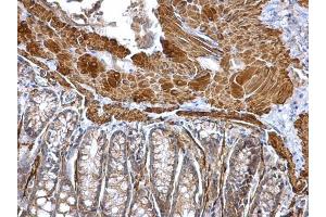 IHC-P Image alpha smooth muscle Actin antibody detects alpha smooth muscle Actin protein at cytosol on mouse colon by immunohistochemical analysis. (Smooth Muscle Actin 抗体  (N-Term))