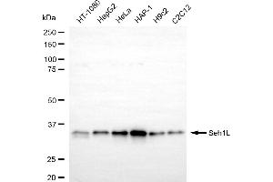 Western blotting analysis using Seh1L antibody (ABIN7800290). (Recombinant SEH1L 抗体)