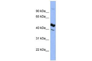 SERPIND1 antibody used at 1 ug/ml to detect target protein. (SERPIND1 抗体)