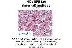 Image no. 1 for anti-G Protein-Coupled Receptor 126 (GPR126) (Internal Region) antibody (ABIN1734924) (G Protein-Coupled Receptor 126 抗体  (Internal Region))