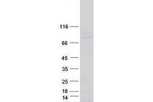 Western Blotting (WB) image for Polymerase (DNA Directed) iota (POLI) protein (Myc-DYKDDDDK Tag) (ABIN2719557)