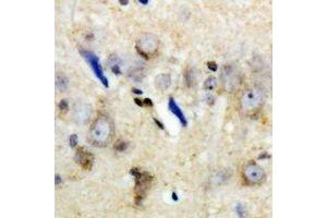 Immunohistochemical analysis of LC3A staining in human brain formalin fixed paraffin embedded tissue section. (MAP1LC3A 抗体)