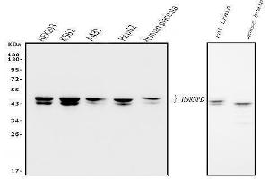 Western blot analysis of hnRNP D/AUF1/HNRNPD using anti-hnRNP D/AUF1/HNRNPD antibody (ABIN7602591). (HNRNPD/AUF1 抗体  (AA 88-246))
