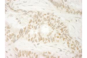 Immunohistochemistry (IHC) image for anti-Makorin Ring Finger Protein 1 (MKRN1) (C-Term) antibody (ABIN7448670) (MKRN1 抗体  (C-Term))