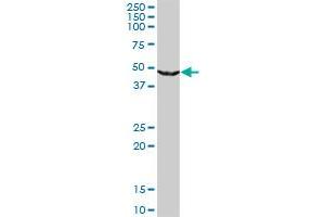 UPB1 monoclonal antibody (M09), clone 3F12. (UPB1 抗体  (AA 285-384))