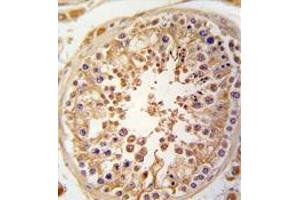Formalin-fixed and paraffin-embedded human testis tissue reacted with SPAG9 antibody (N-term) , which was peroxidase-conjugated to the secondary antibody, followed by DAB staining. (SPAG9 抗体  (N-Term))