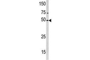 Western blot analysis of PXK antibody and HeLa lysate (PXK 抗体  (AA 221-251))