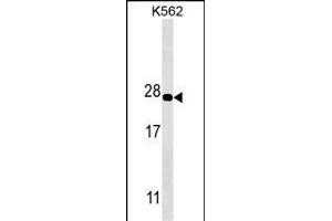 PS Antibody (ABIN1539887 and ABIN2843849) western blot analysis in K562 cell line lysates (35 μg/lane). (PSMA5 抗体)
