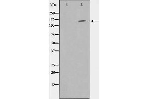 Western blot analysis on HepG2 cell lysate using SHIP1 Antibody,The lane on the left is treated with the antigen-specific peptide. (INPP5D 抗体  (C-Term))