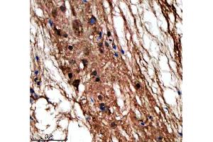 IHC analysis of LIN9 using anti-LIN9 antibody (AZQ5RHQ8).