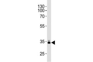 Western blot analysis of lysate from human plasma tissue lysate using ApoE antibody diluted at 1:1000. (APOE 抗体  (AA 263-292))