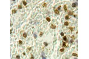 Used in DAB staining on fromalin fixed paraffin-embedded Spleen tissue (HPSE 抗体  (AA 400-543))