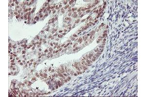 Image no. 3 for anti-Ring Finger Protein 113B (RNF113B) antibody (ABIN1500718) (RNF113B 抗体)