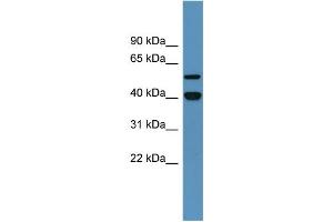 Western Blotting (WB) image for anti-Damage-Specific DNA Binding Protein 2, 48kDa (DDB2) (C-Term) antibody (ABIN2788357) (DDB2 抗体  (C-Term))