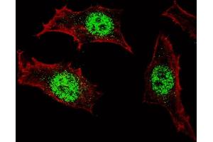 Fluorescent confocal image of HeLa cells stained with (ABIN389189 and ABIN2839352) KLF4 antibody. (KLF4 抗体)