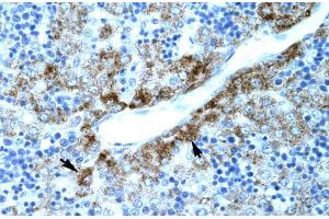 Human Liver; SLC30A9 antibody - N-terminal region in Human Liver cells using Immunohistochemistry (SLC30A9 抗体  (N-Term))