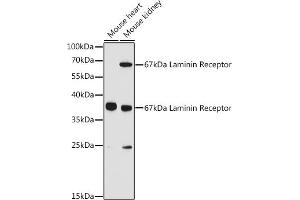 Western blot analysis of extracts of various cell lines, using 67 kDa Laminin Receptor antibody (ABIN6128199, ABIN6147247, ABIN6147248 and ABIN6224857) at 1:3000 dilution. (RPSA/Laminin Receptor 抗体  (AA 1-295))