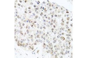 Immunohistochemistry (Paraffin-embedded Sections) (IHC (p)) image for anti-Centrin, EF-Hand Protein, 3 (CETN3) (AA 1-167) antibody (ABIN6138444)