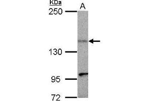 WB Image Sample (30 ug of whole cell lysate) A: HepG2 5% SDS PAGE antibody diluted at 1:500 (KIF1C 抗体)