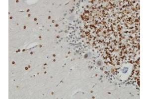 Image no. 2 for anti-Nucleoprotein TPR (TPR) (AA 1-99) antibody (ABIN598986) (TPR 抗体  (AA 1-99))
