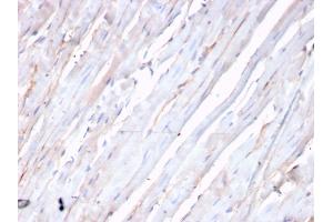 Formalin-fixed, paraffin-embedded human heart stained with N-Cadherin Recombinant Rabbit Monoclonal Antibody (CDH2/3874R). (Recombinant N-Cadherin 抗体)