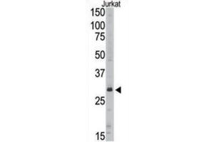 Western Blotting (WB) image for anti-Sirtuin 5 (SIRT5) antibody (ABIN3002566) (SIRT5 抗体)