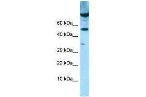 WB Suggested Anti-PDE7A Antibody Titration: 1. (PDE7A 抗体  (C-Term))