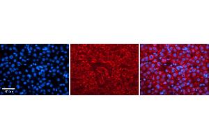 Rabbit Anti-KCNC3 Antibody    Formalin Fixed Paraffin Embedded Tissue: Human Adult liver  Observed Staining: Cytoplasmic Primary Antibody Concentration: 1:600 Secondary Antibody: Donkey anti-Rabbit-Cy2/3 Secondary Antibody Concentration: 1:200 Magnification: 20X Exposure Time: 0.