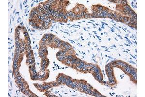 Immunohistochemical staining of paraffin-embedded Human Kidney tissue using anti-IGF2BP2 mouse monoclonal antibody. (IGF2BP2 抗体)