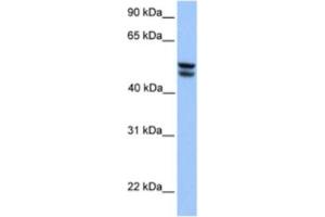 Western Blotting (WB) image for anti-3-Oxoacid CoA Transferase 1 (OXCT1) antibody (ABIN2463188) (OXCT1 抗体)