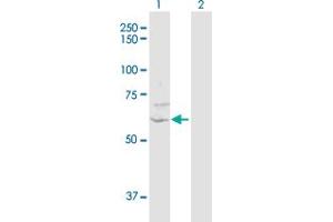 Western Blot analysis of ZNF238 expression in transfected 293T cell line by ZNF238 MaxPab polyclonal antibody. (ZNF238 抗体  (AA 1-522))